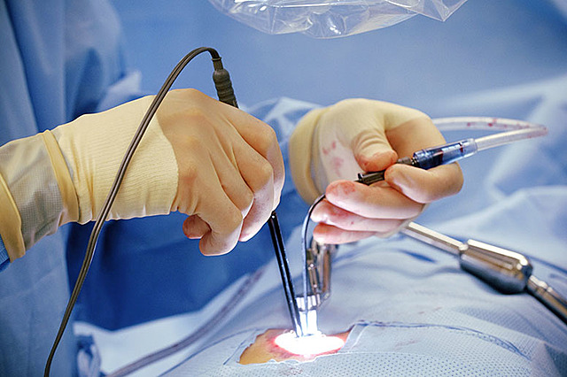 Minimally Invasive Procedures