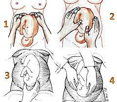 Maniobras de Leopold
