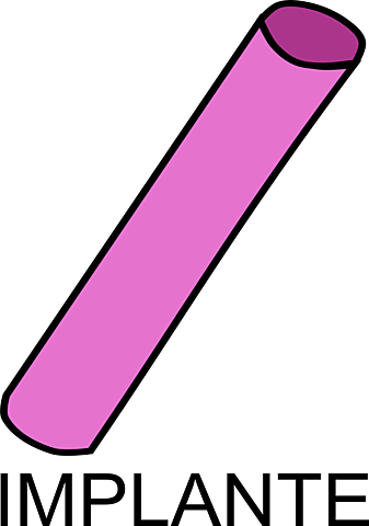implante
