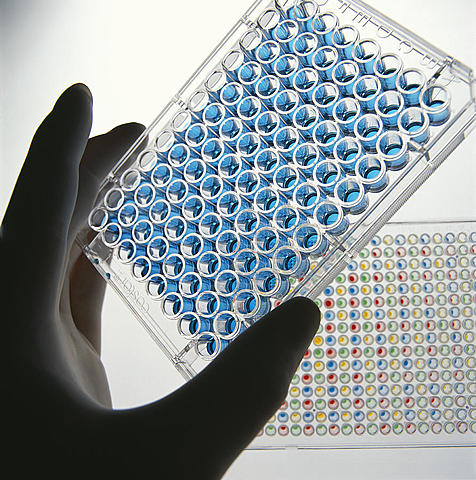 ELISA Test
