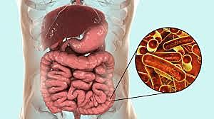 Orígenes de la disentería y su relación con la fiebre entérica