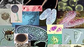 Timeline: Historia de la microbiología