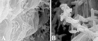 Primer proceso industrial aséptico.