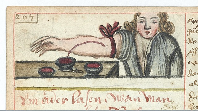 Egyptians used bloodletting to try to cure disease