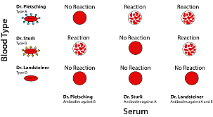 Karl Landsteiner discovered three blood types: A, B, O
