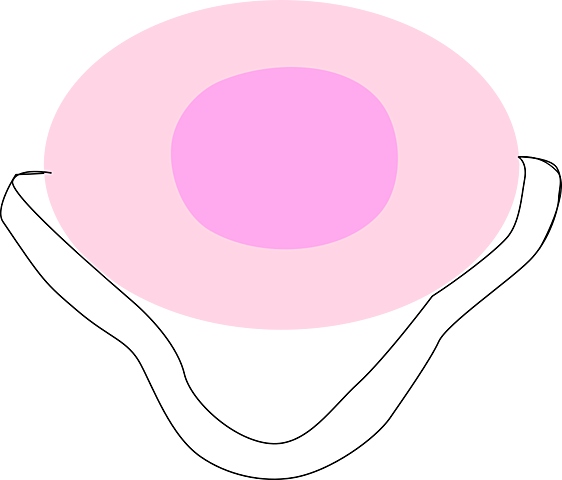 Esponja anticonceptiva