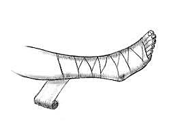 em faig el primer esguinç