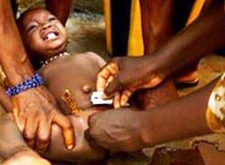 La medicina contra la mutilación genital femenina