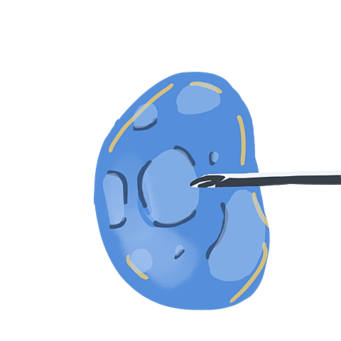 Fecundación In vitro