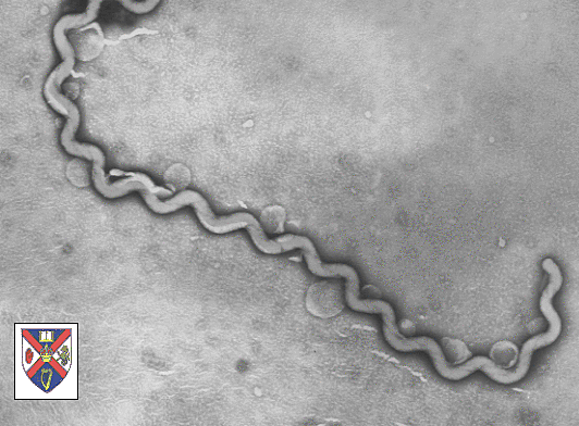 Las leptospiras se observaron por primera vez