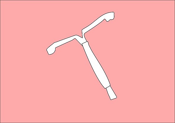 Dispositivo intrauterino Diu