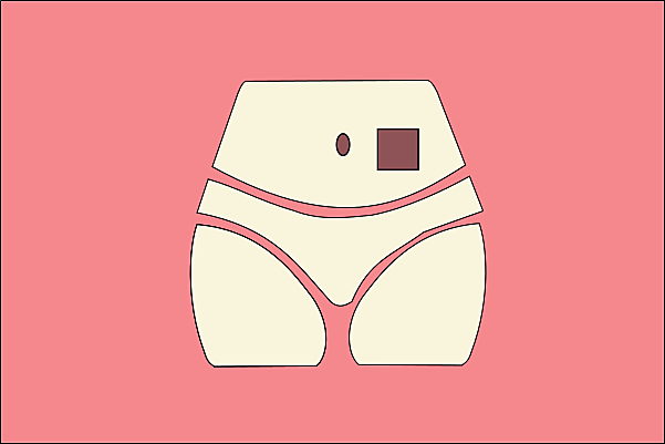 Parche anticonceptivo