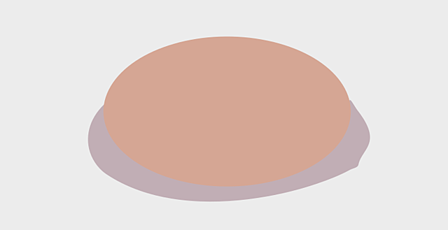 Diafragma Anticonceptivo