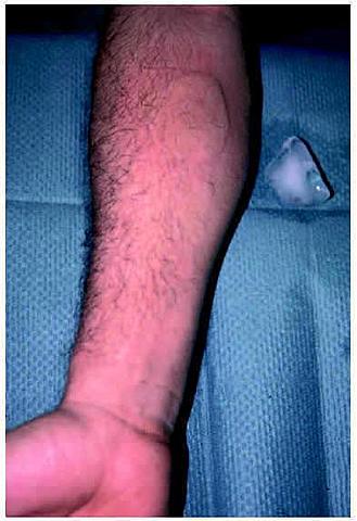 Otras partes del mundo antiguo