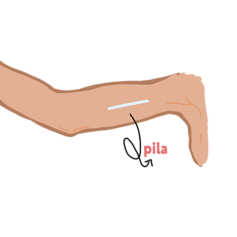 Implante Subdérmico