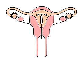 Implante uterino