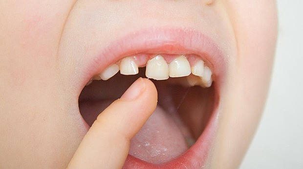 em cau l'última dent de llet