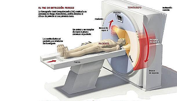 LA NEUROPSICOLOGÍA AUMENTO