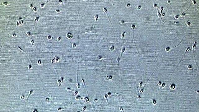 Nombre de espermatozoides