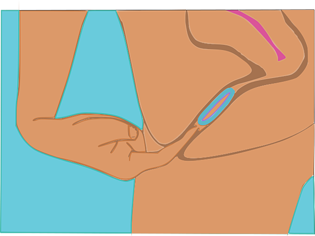 anillo vaginal