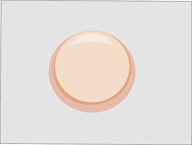 diafragma anticonceptivo