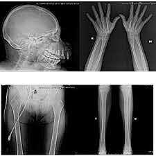Visión Anatomopatológica