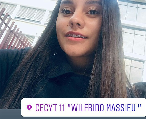 Me pusieron brackets