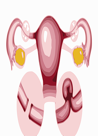 Ligadura de trompas de falopio