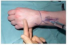 El despertar de la Coca