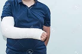 I FRACTURE MY RADIUS