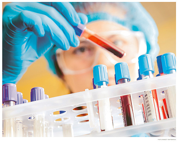 Scientists began developing blood-screening tests for infectious diseases