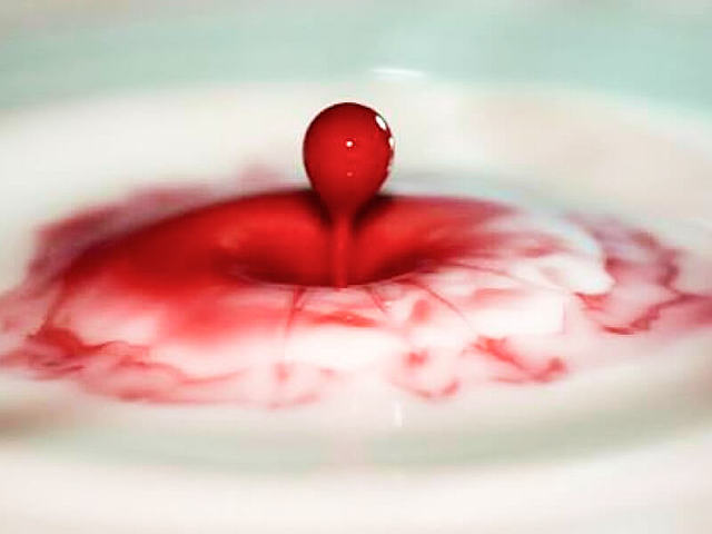 Transfusión  sanguínea con leche