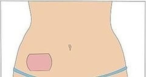 Parche Anticonceptivo