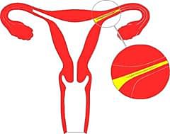 Cirugía Esterilizadora