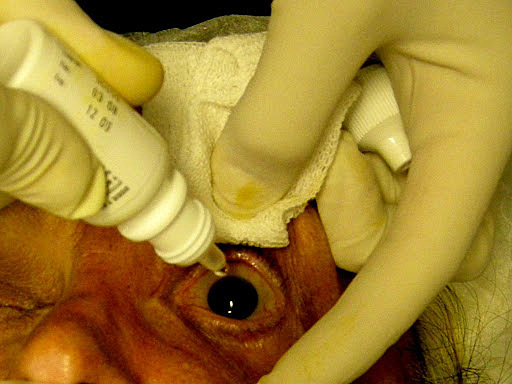 Introducción de la cocaína como anestésico en cirugía oftálmica por Karl Köller