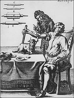 Primera transfusión de un humano