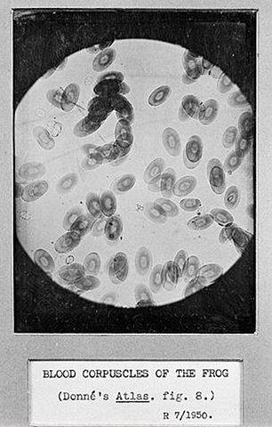 Descubrimiento de las plaquetas