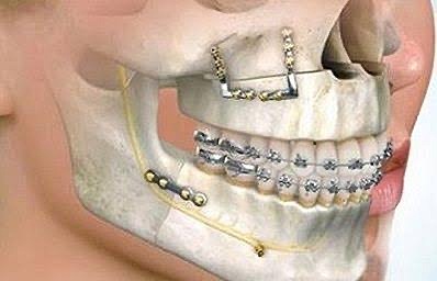 Especialidad cirugía oral