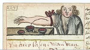 Egyptians tried using blood letting to cure diseases