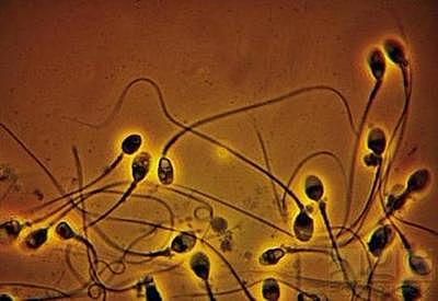 Se contempla el esperma animal a través del microscopio