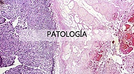 Timeline: HISTORIA DE LA PATOLOGÍA