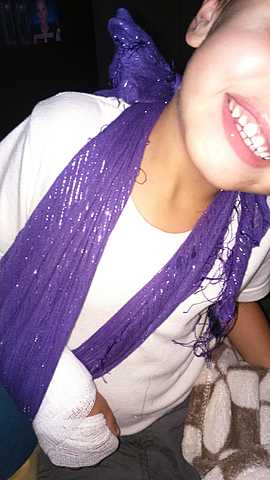 BROKEN RIGHT RADIO BONE