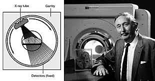 Sistema inicial tomográfico