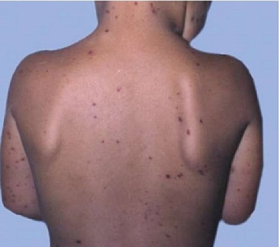 WHEN I HAD AN ILLNESS