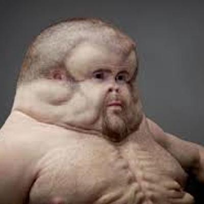 Timeline: Distopia: la vacuna mutante