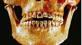 Timeline: momentos historicos de la odontologia