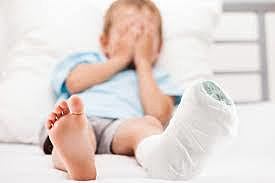 Me fracturé la pierna