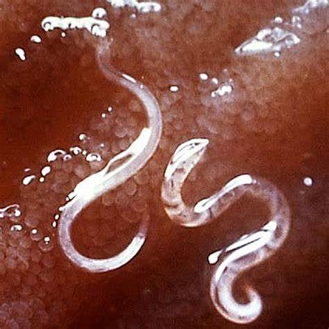 Se intensificaron las campañas contra diversas parasitosis, como la oncocercosis y se implantó la pasteurización de la leche en el Distrito Federal.