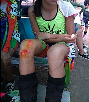 my worst fall in skating