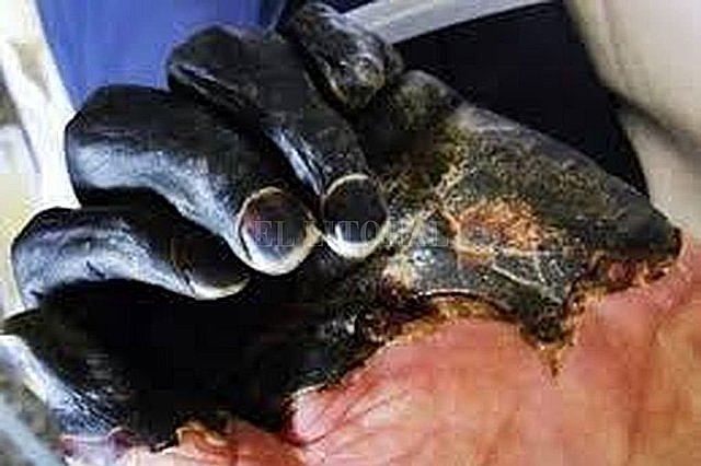 LA ENFERMEDAD Y LA SUPERSTICIÓN